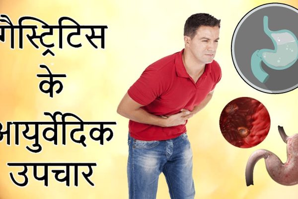 ग्यास्ट्राइटिस समस्याले धेरैलाई सताइरहेको हुन्छ ?ग्यास्ट्राइटिस भए के गर्ने ?